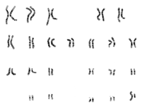 karyotypes